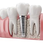 마사지가 왜 이렇게 좋은 이유