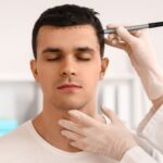 Hair Transplant Turkey - Where To Start