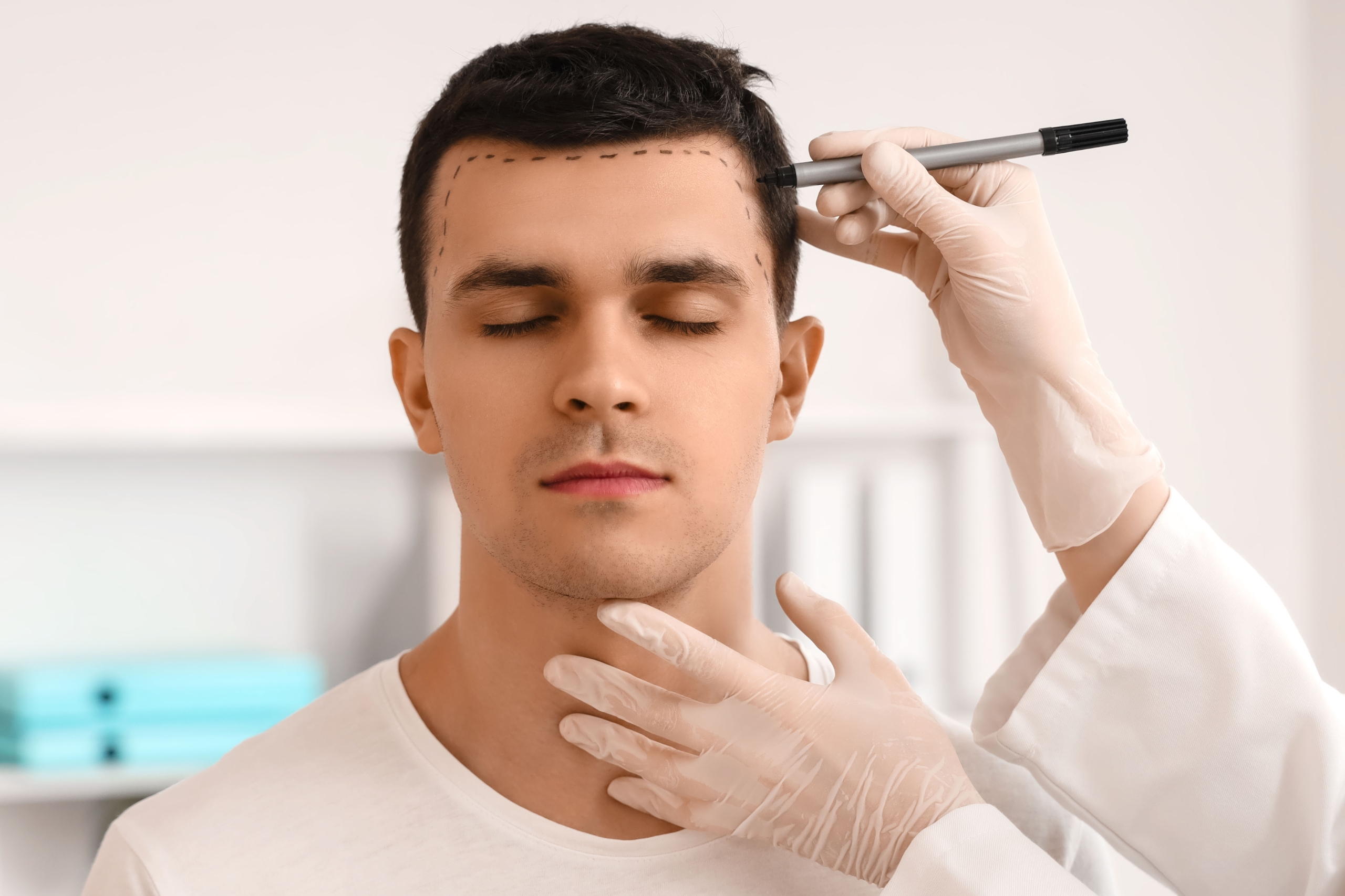 Hair Transplant Turkey – Where To Start?